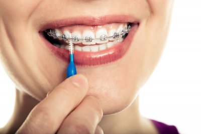 كورس تأهيلي لإجتياز اختبار الهيئة الصحية لطب الاسنان  Saudi Dental Licensure Examination (SDLE)